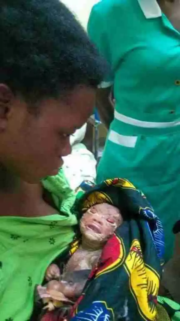 Nigerians React As Young Girl Gives Birth To ”Strange” Baby (Graphic Photos)